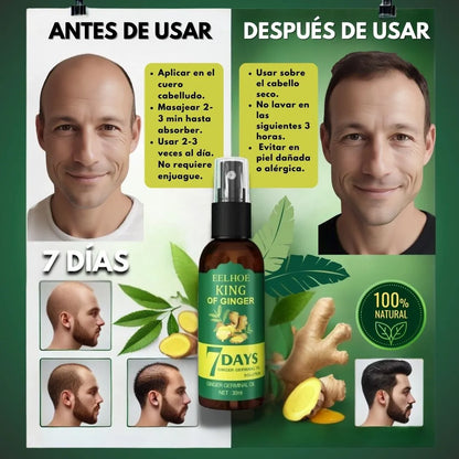 7 DÍAS: Tónico Para El Crecimiento Del Cabello.
