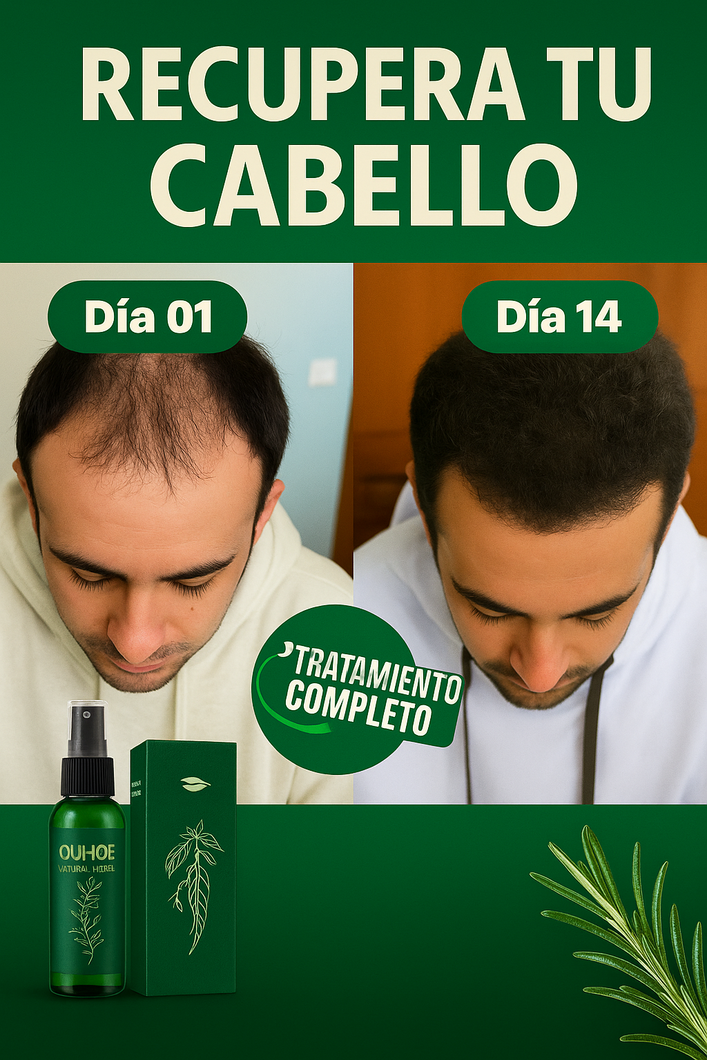 OUHOE® – Tónico para el crecimiento del cabello.