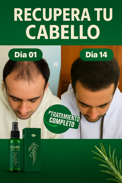 OUHOE® – Tónico para el crecimiento del cabello.